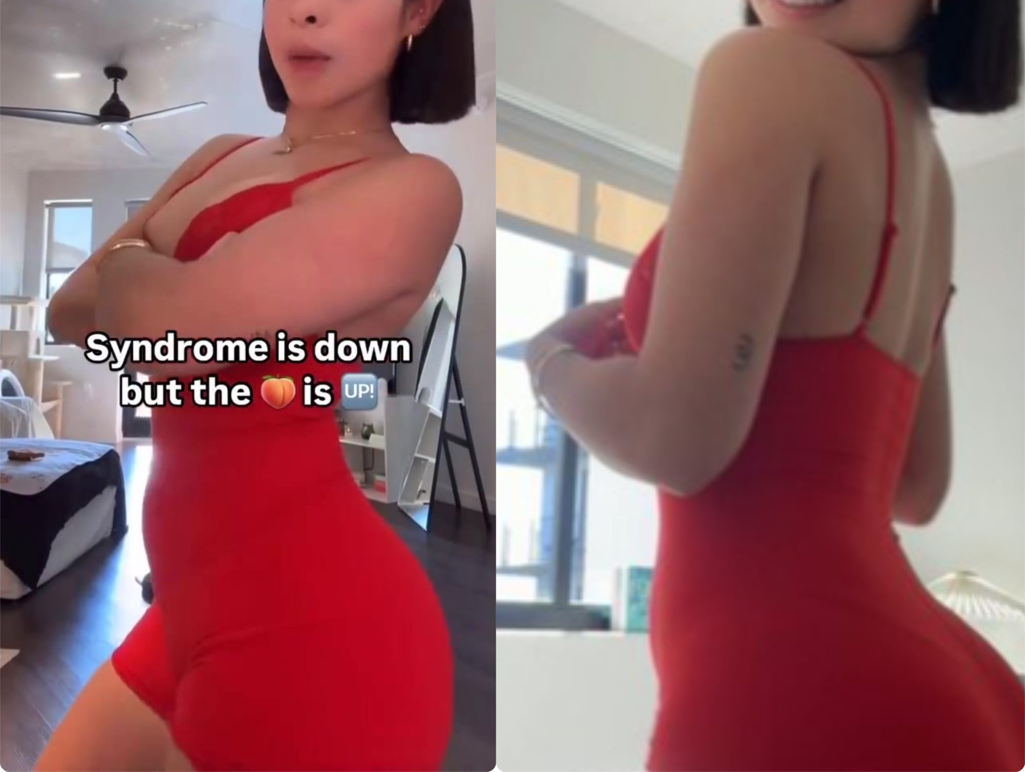 Littleminaxo Syndrome is down but the down is up