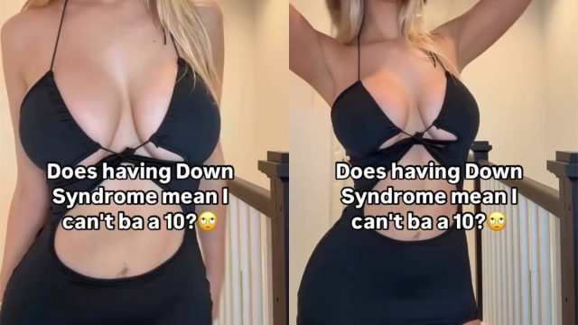 Jennysospecial @special_withlove Down Syndrome – Hot Sexy